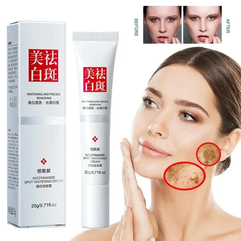 Skincare Niacinamide - Fades Freckle Dark Spots Face Cream