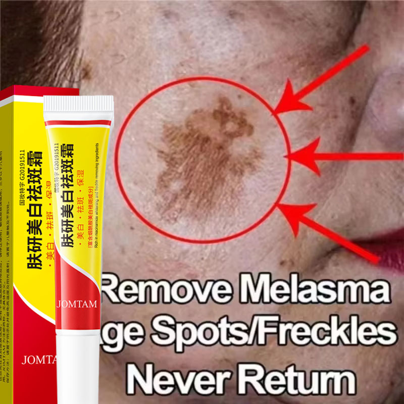 Skincare Niacinamide - Whitening Freckle Cream Face Brightening Cream
