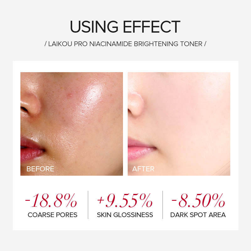 LAIKOU PRO Niacinamide 4Pcs Br - Skincare Niacinamide review and price