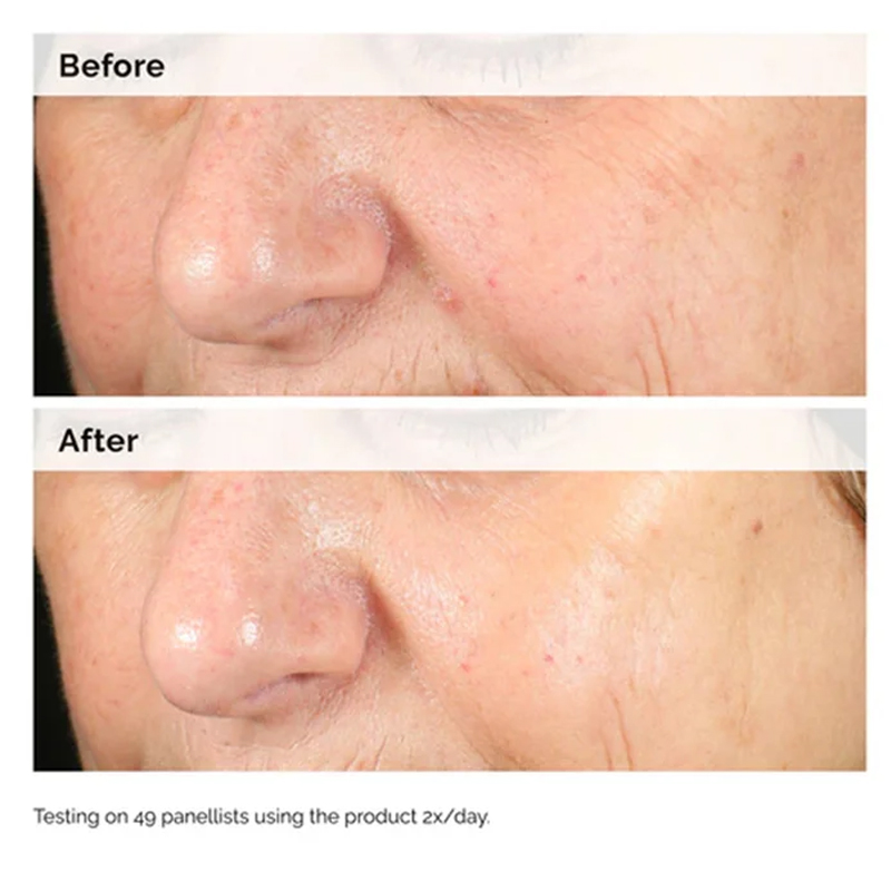 Alpha Arbutin 2% + HA 30ml Ser - Aha Bha Exfoliant review and price