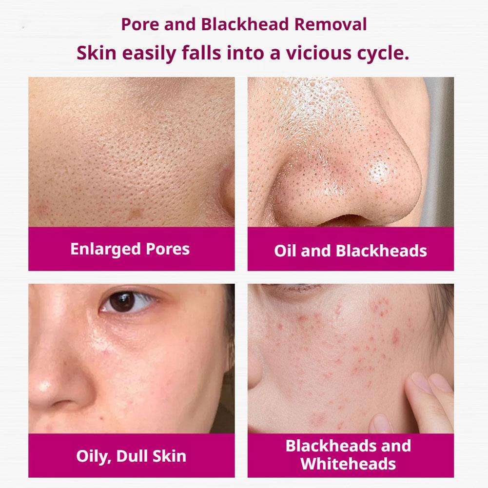 Salicylic Acid Shrink Pores Se - Glycolic Acid Exfoliant review and price
