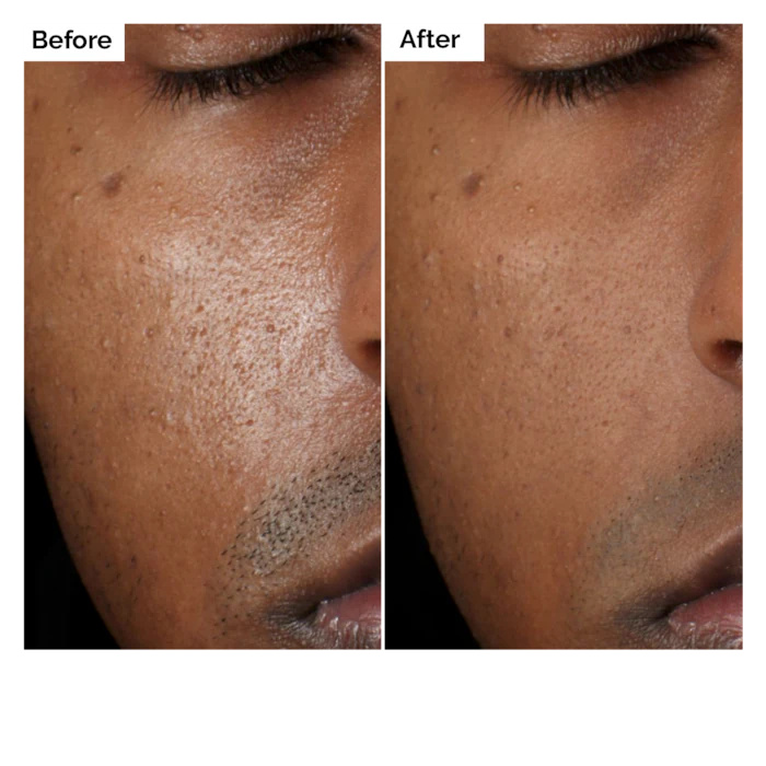 Aloe 2% + NAG 2% Solution Seru - Aha Bha Exfoliant review and price