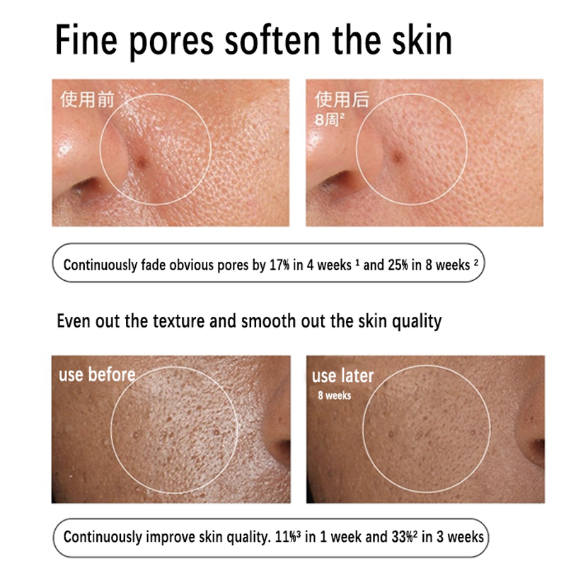 Aloe 2% + NAG 2% Solution Seru - Aha Bha Exfoliant review and price