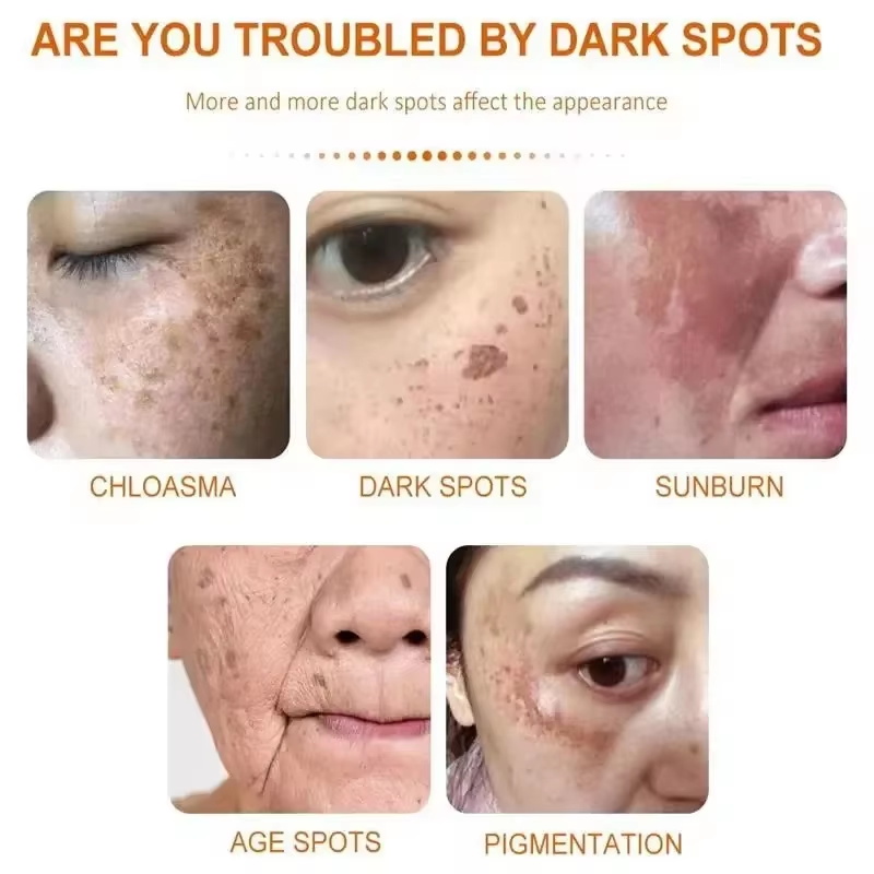 Whitening Freckle Cream Face B - Skincare Niacinamide review and price
