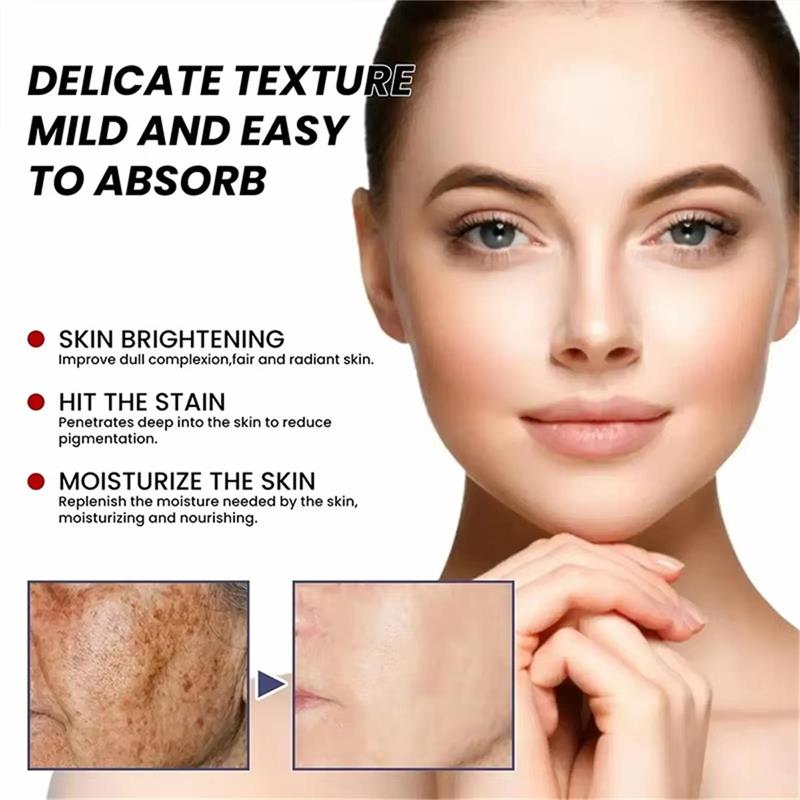 Whitening Freckle Cream Face B - Skincare Niacinamide review and price