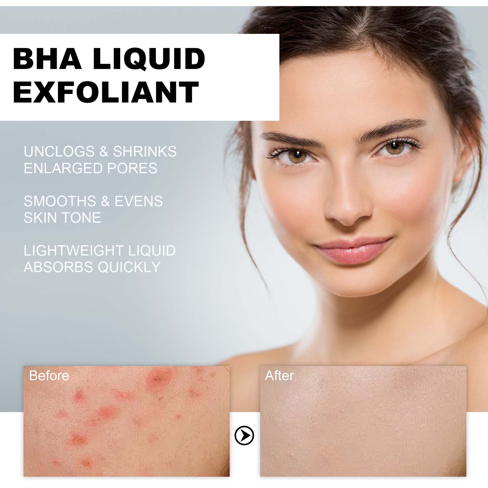 2% Salicylic Acid Liquid Exfol - Glycolic Acid Exfoliant review and price