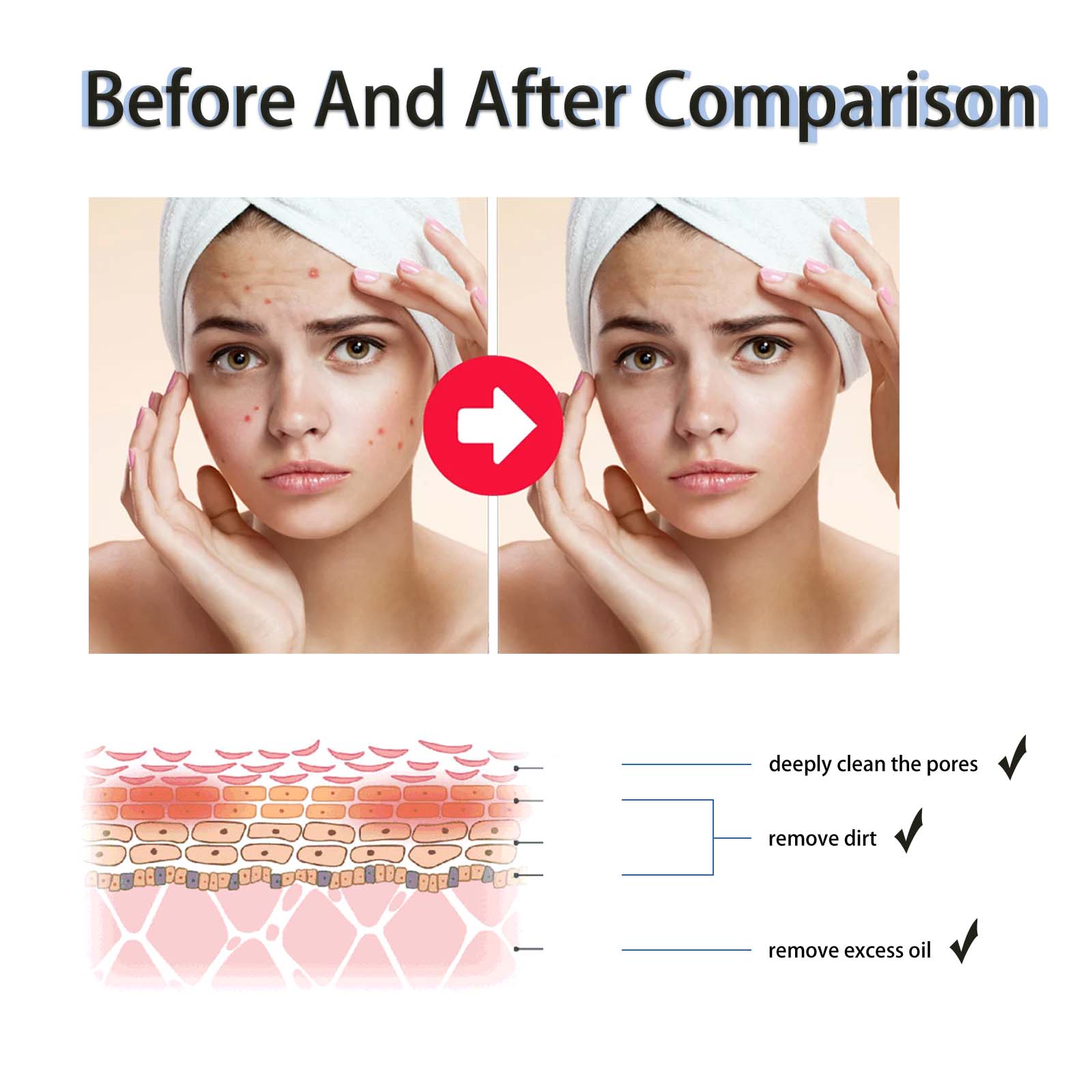 2% Salicylic Acid Liquid Exfol - Glycolic Acid Exfoliant review and price