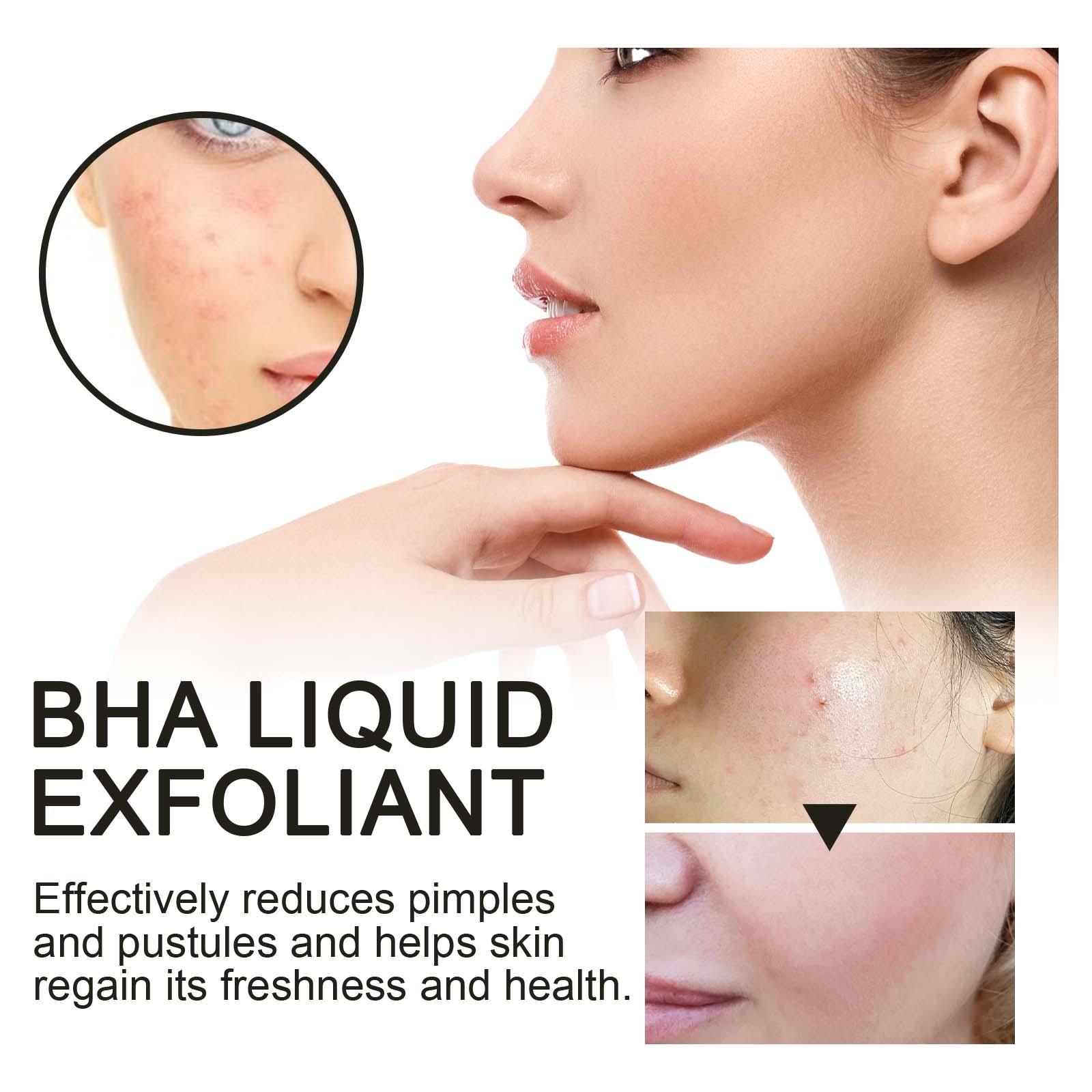2% Salicylic Acid Liquid Exfol - Glycolic Acid Exfoliant review and price